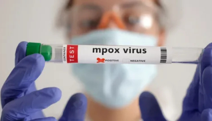 Entenda o surto do virus MPOX: causas, sintomas e dicas de prevenção. Conheça tudo sobre a atual crise do vírus MPOX no Brasil.